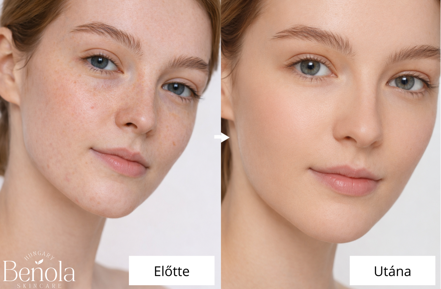 Benola™ - GlowDuo, multifunkciós balzsam és színváltó alapozó